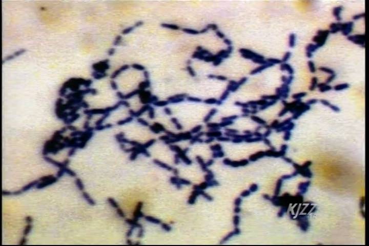 Pictures Of Streptococci